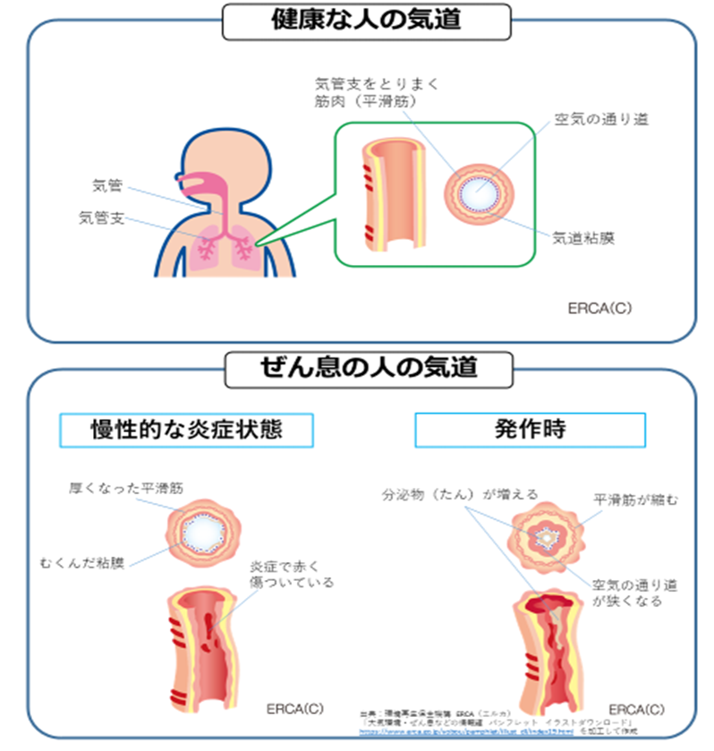 気管支の断面図