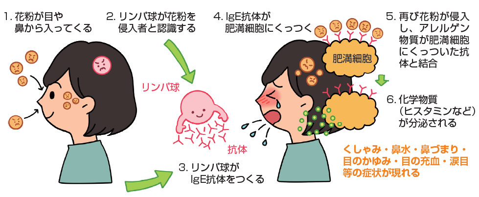 画像：花粉が体内に入り抗体が出来ることで化学物質が分泌されるようになり花粉症の症状が起こります