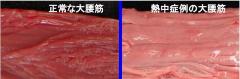 正常な大腰筋 熱中症例の大腰筋の比較画像