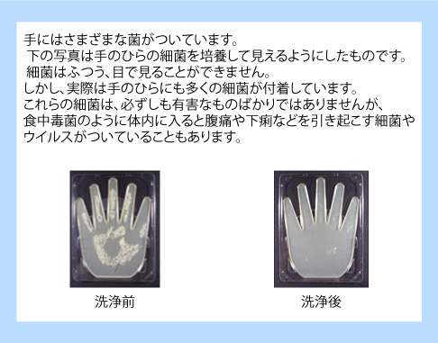 食中毒に関すること