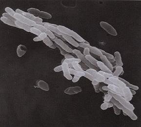 結核菌の電子顕微鏡の写真