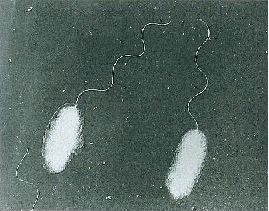Photo :Vibrio parahaemolyticus